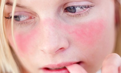 Rash around the Eyes: Causes and Natural Treatments