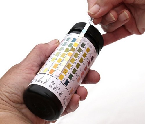 Normal Leukocyte Count In Urine Dipstick