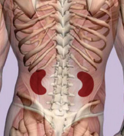 Kidney Pain - (Location, anatomy), lower back, Vs Back pain, Causes