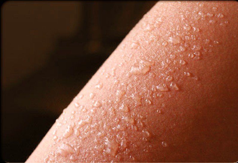 Red Itchy Bumps On Arms After Sun Exposure