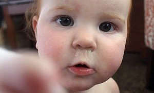 Healthoolrhinorrhea | Healthool