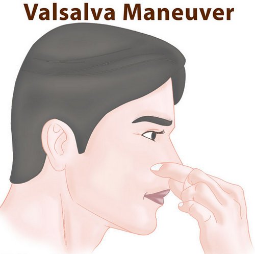 Valsalva maneuver.picture