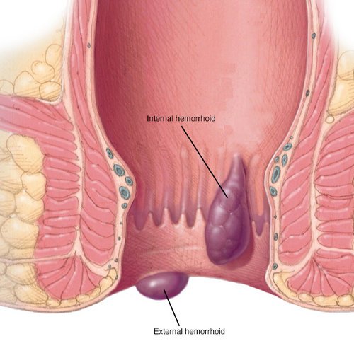 anal openin on Bump