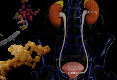 the different bacteria that can invade the urinary tract to eventually cause kidney infections.image