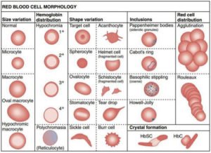 👉 MCHC Blood Test -What does it mean, Normal range (Low, High ...