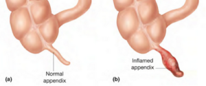 👉 Appendix - Location, Pain, Function and Pictures (January 2022)