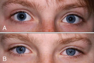 pinpoint pupils meaning