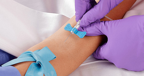 A blue tourniquet wrapped around the patient’s arm and a butterfly needle inserted into the veins photo image picture