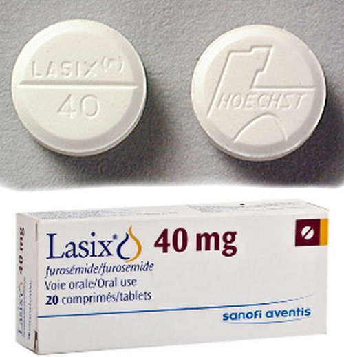 Lasix is a diuretic of choice for patient with anasarca image picture photo