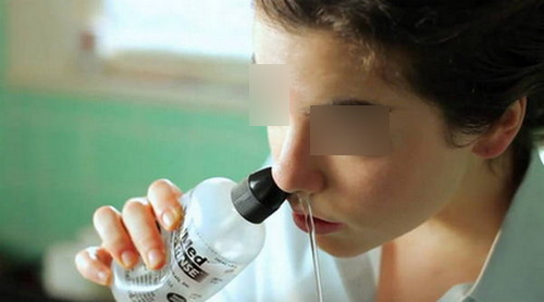 A saline solution is used to irrigate the pimple in the nose bump image photo picture