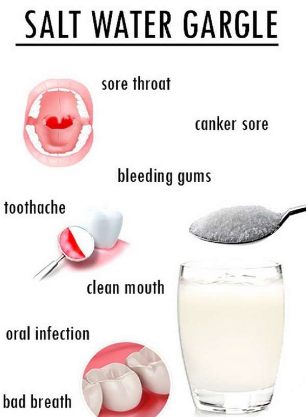 A salt water gargle is one of the cheapest home remedies for oral herpes picture image photo