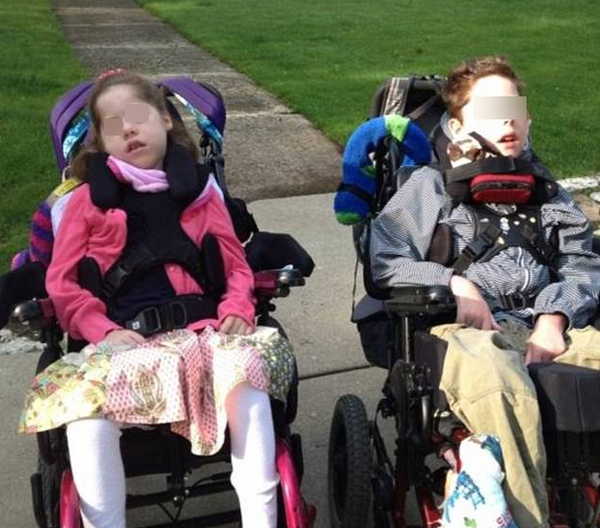 The siblings both have a Batten disease image photo picture