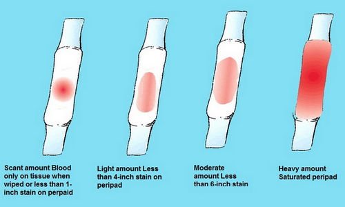 👉 What Is Implantation Bleeding When And How Long Does It Occur