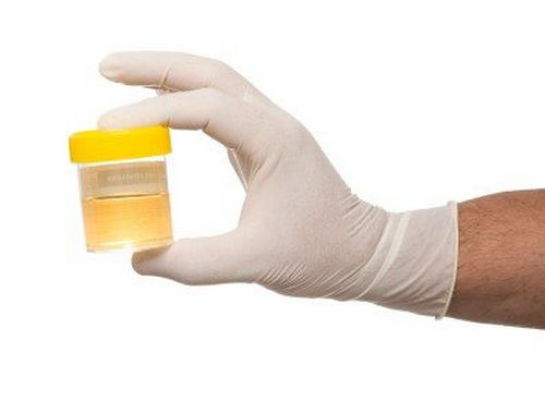 A freshly catch urine is checked for alcohol metabolites image photo picture